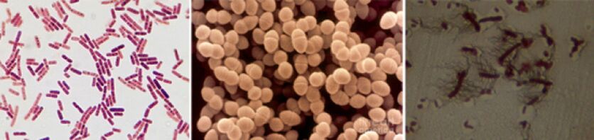 Escherichia -Sticks, Fecal και Pro - Τα κύρια παθογόνα της χρόνιας βακτηριακής προστατίτιδας